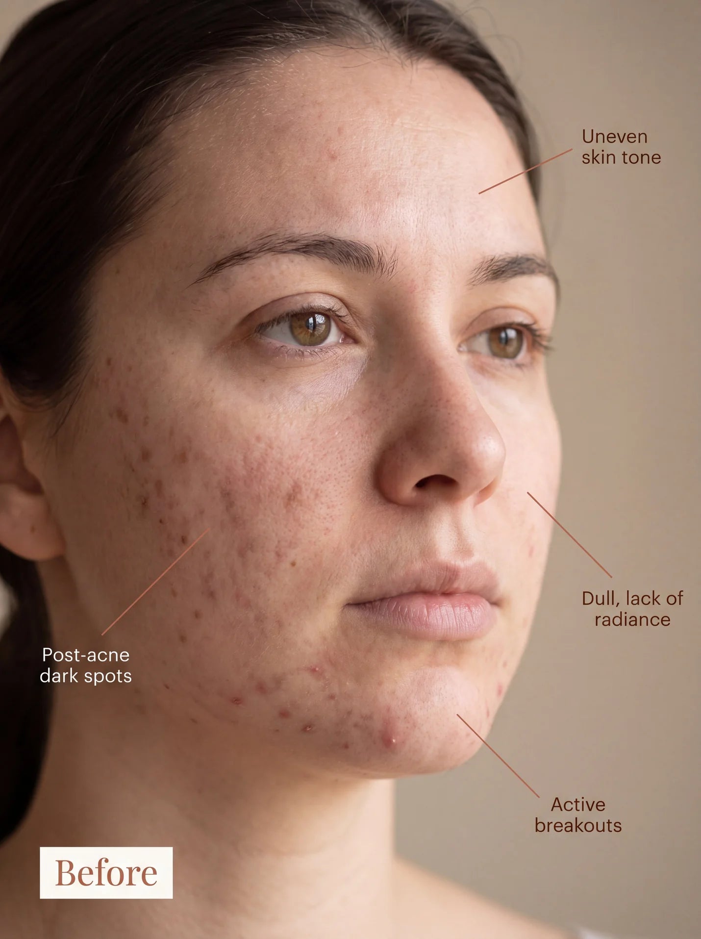 Innera™ SkinRevive Pro — Red Light LED Face & Neck Therapy Mask